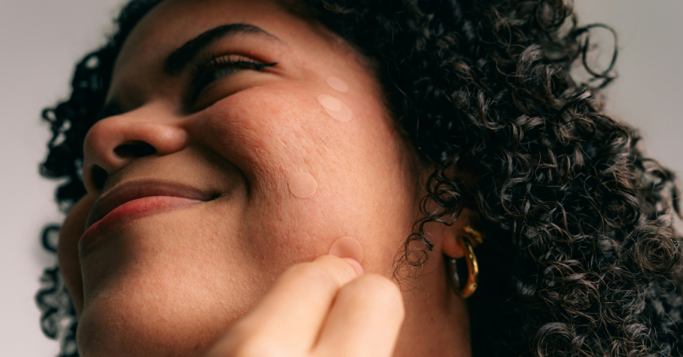 Testés : ces 5 patchs anti-acné font des merveilles