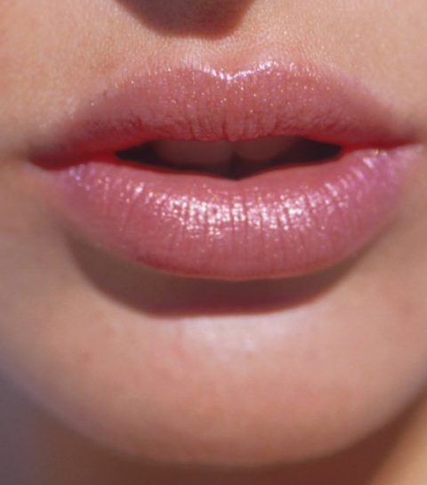 Hoe verzorg je gebarsten lippen?