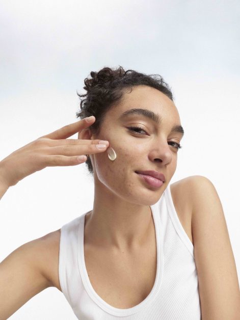 menstruele acne